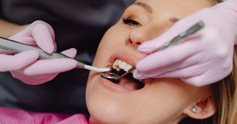 Are Dental Fillings Permanent?